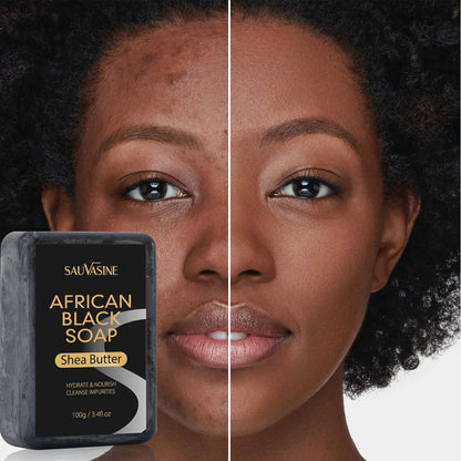 African Black Soap – Deep Cleansing & Moisturizing Body Soap